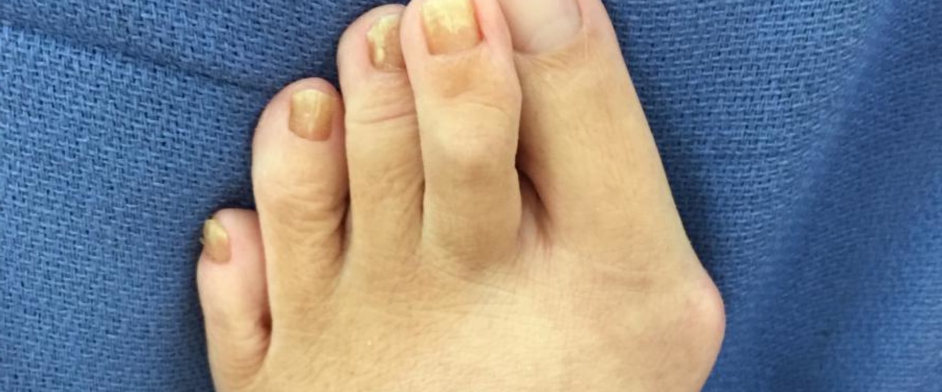 Expert Insights: Common Foot Problems Treated by Podiatrists