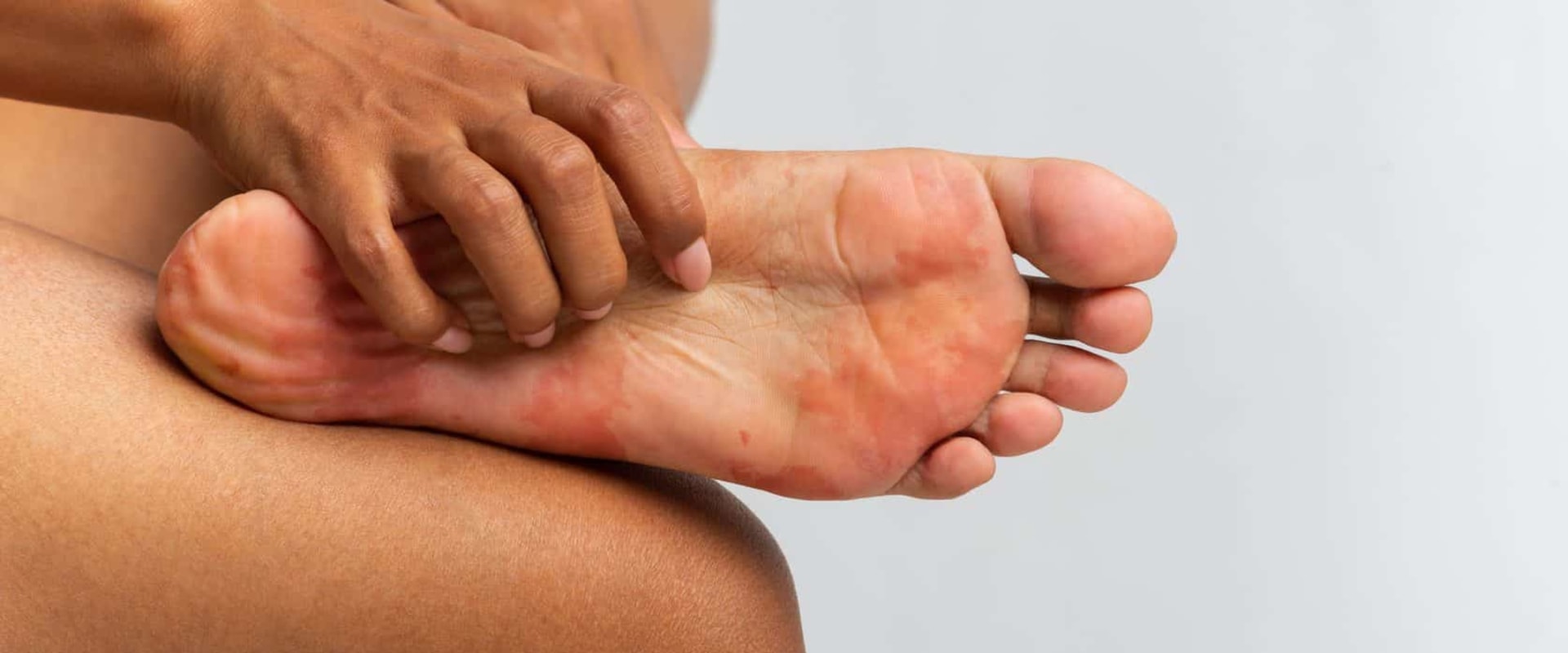 Why Does My Foot Have Red Spots? Warning Signs That Require Emergency Podiatry