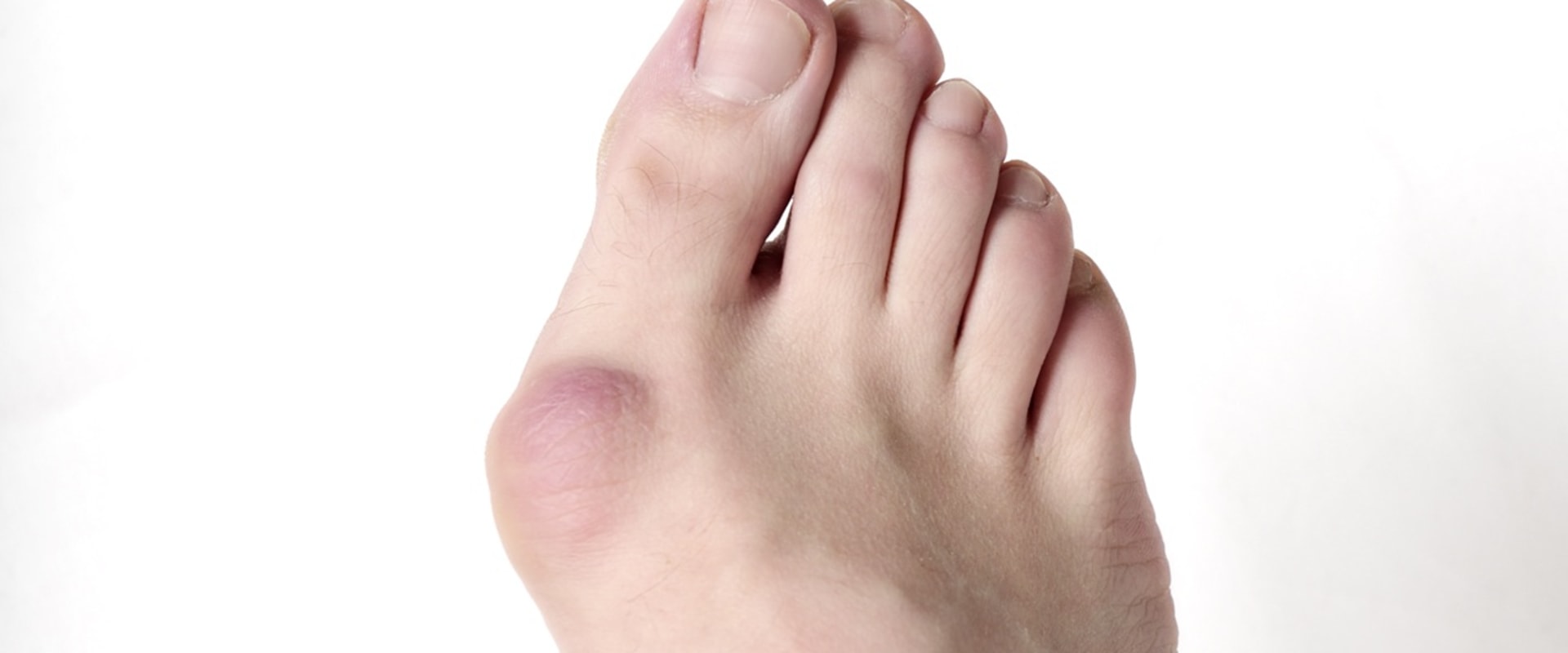 Expert Insights: Understanding and Managing Painful Foot Conditions