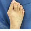 Expert Insights: Common Foot Problems Treated by Podiatrists