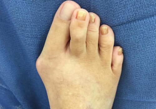 Expert Insights: Common Foot Problems Treated by Podiatrists