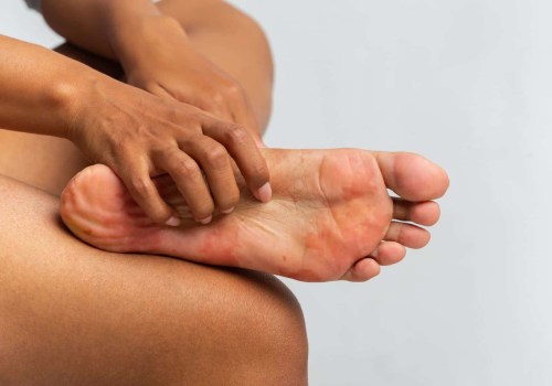 Why Does My Foot Have Red Spots? Warning Signs That Require Emergency Podiatry