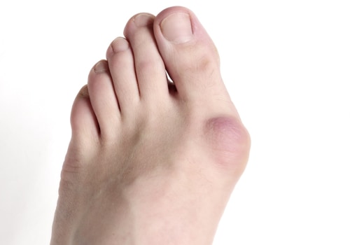 Expert Insights: Understanding and Managing Painful Foot Conditions